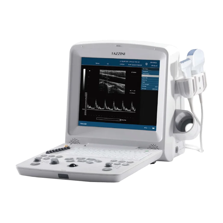 DUS 60 | Digital ultrasonic diagnostic imaging system