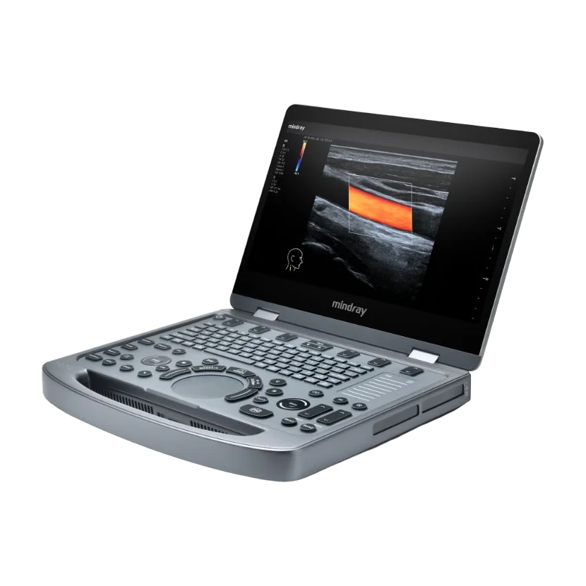 MX3