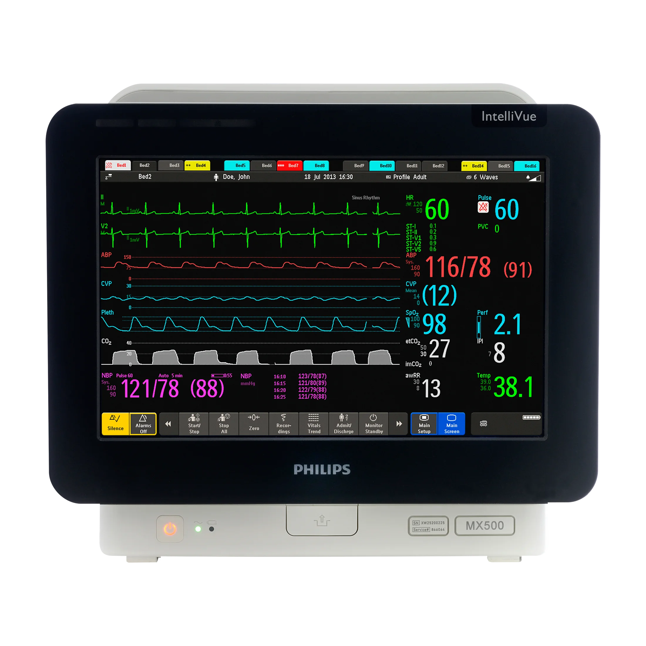 IntelliVue MX500