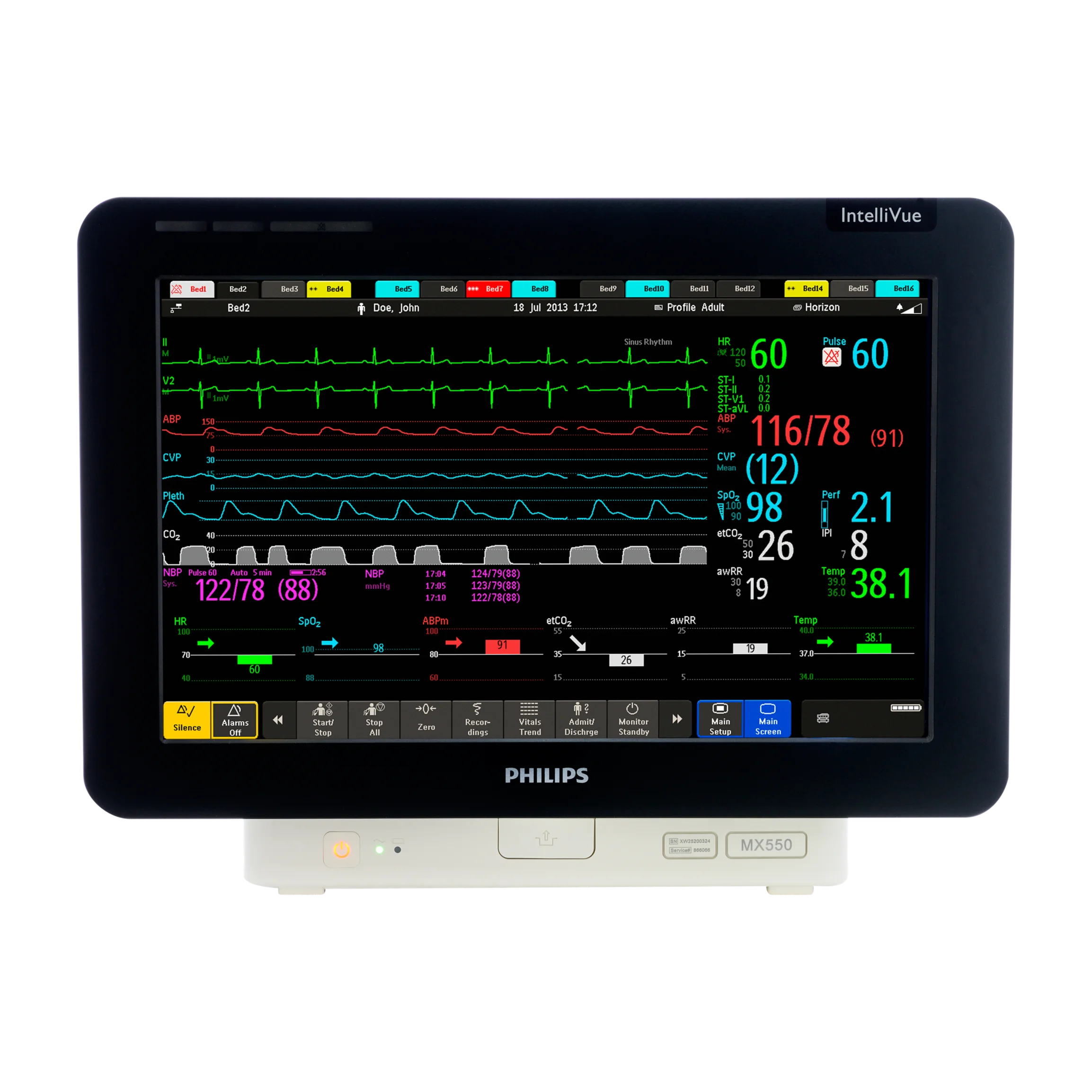 IntelliVue MX550