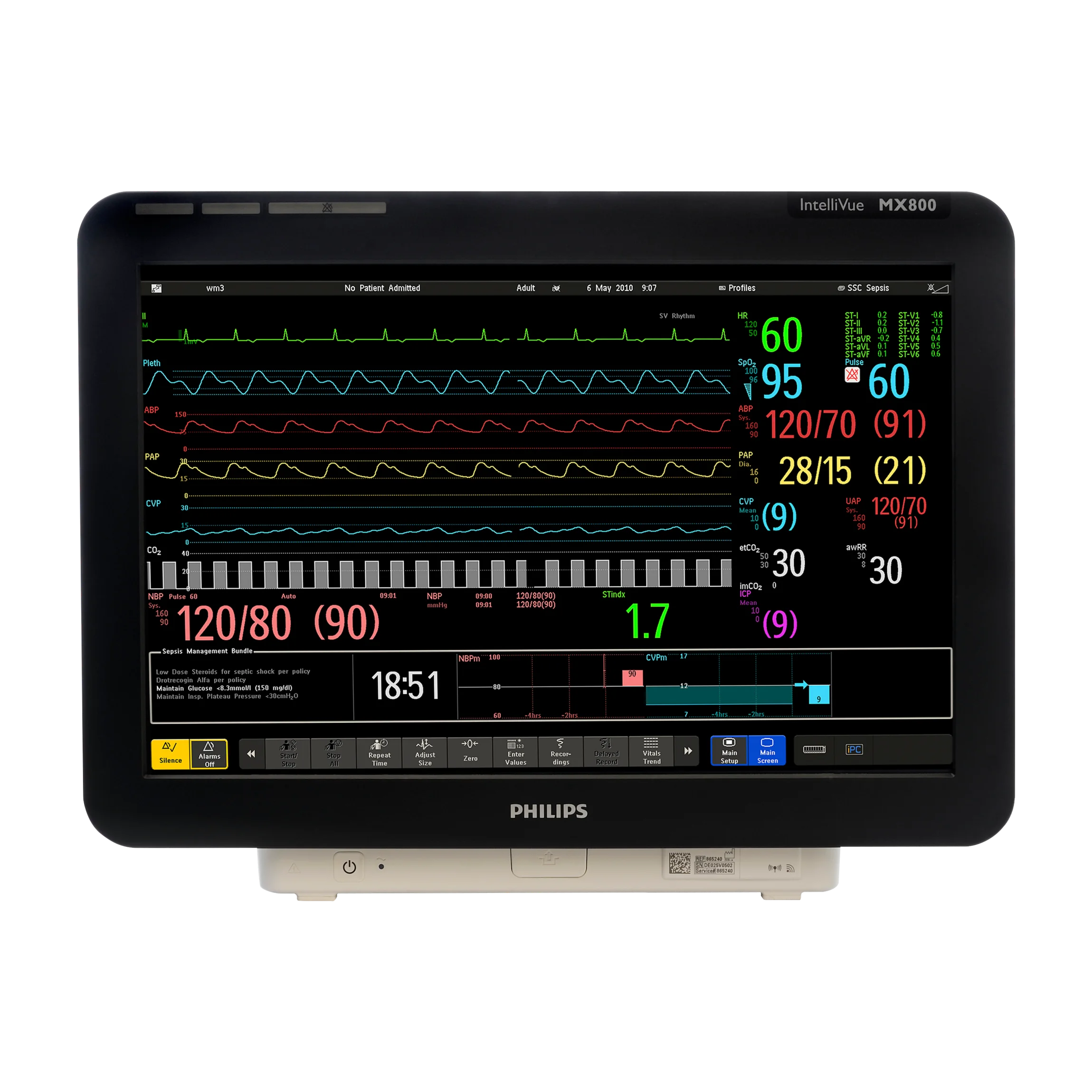 IntelliVue MX800