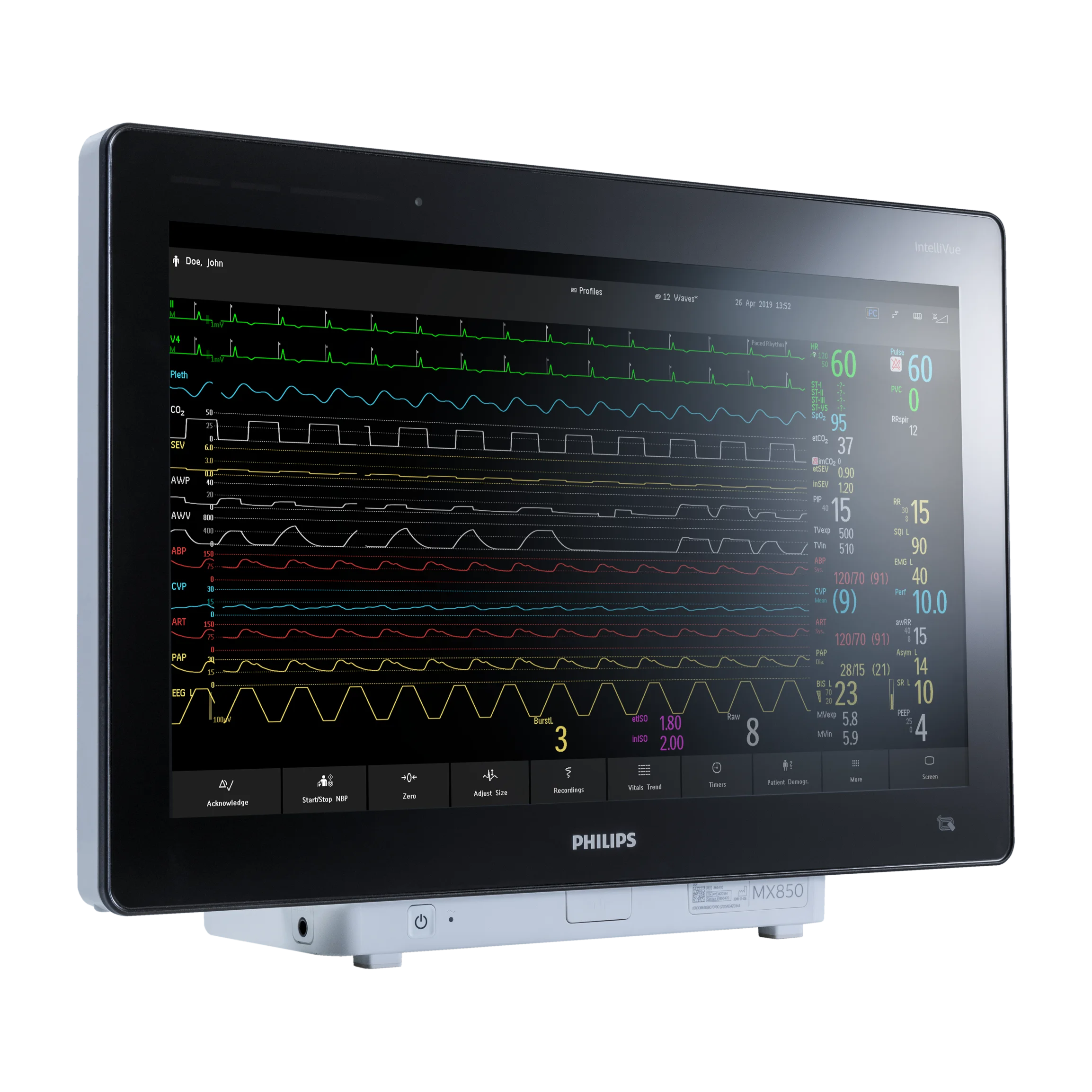 IntelliVue MX850